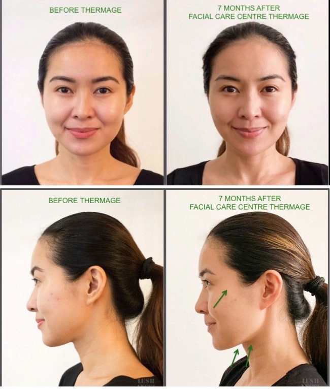Bên cạnh tập luyện thể dục hà hồ hé lộ công cuộc làm căng da mặt chống lão hoá - 7