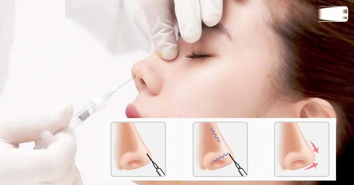 Bị đồn đập đi xây lại nguyên cái mặt hiền hồ bức xúc lên tiếng - 10