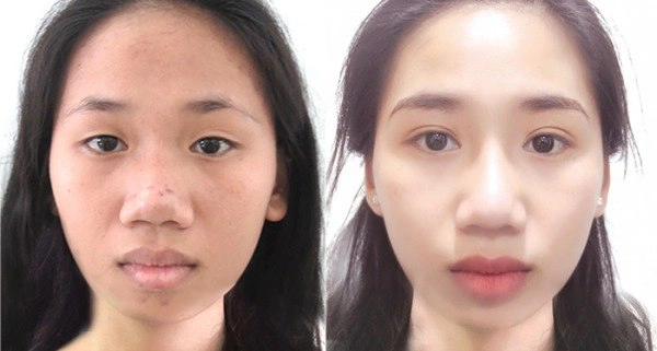 Bị đồn mở góc mắt cắt mí châu bùi đáp trả khéo léo đầy thuyết phục - 13