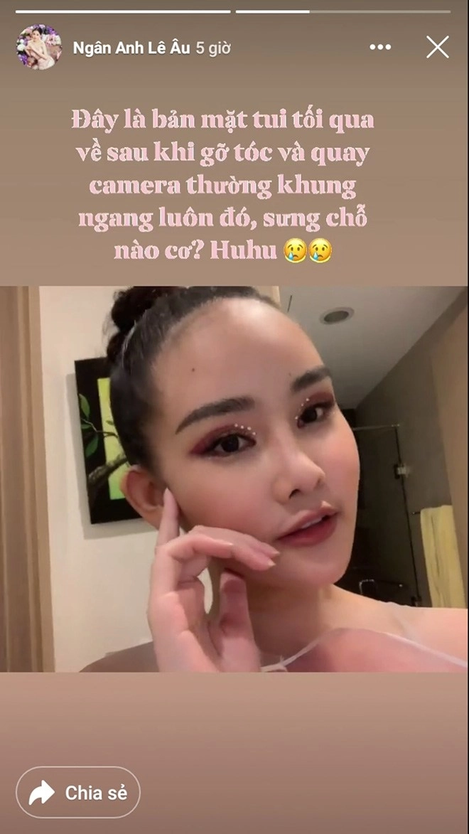 Bị nghi mặt sưng vì dao kéo lê âu ngân anh đăng đàn giải thích liệu có thuyết phục cđm - 3