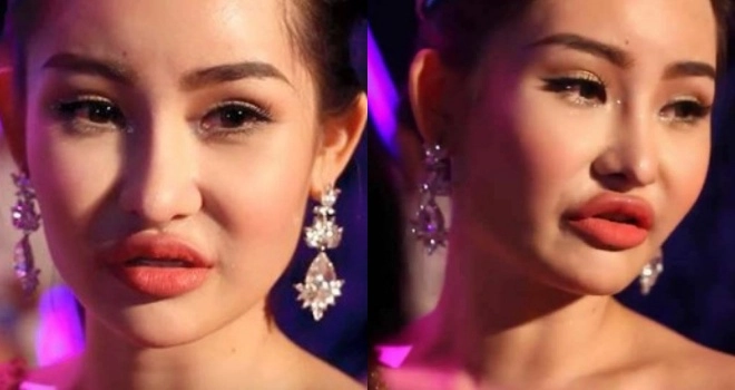Bị nghi mặt sưng vì dao kéo lê âu ngân anh đăng đàn giải thích liệu có thuyết phục cđm - 5