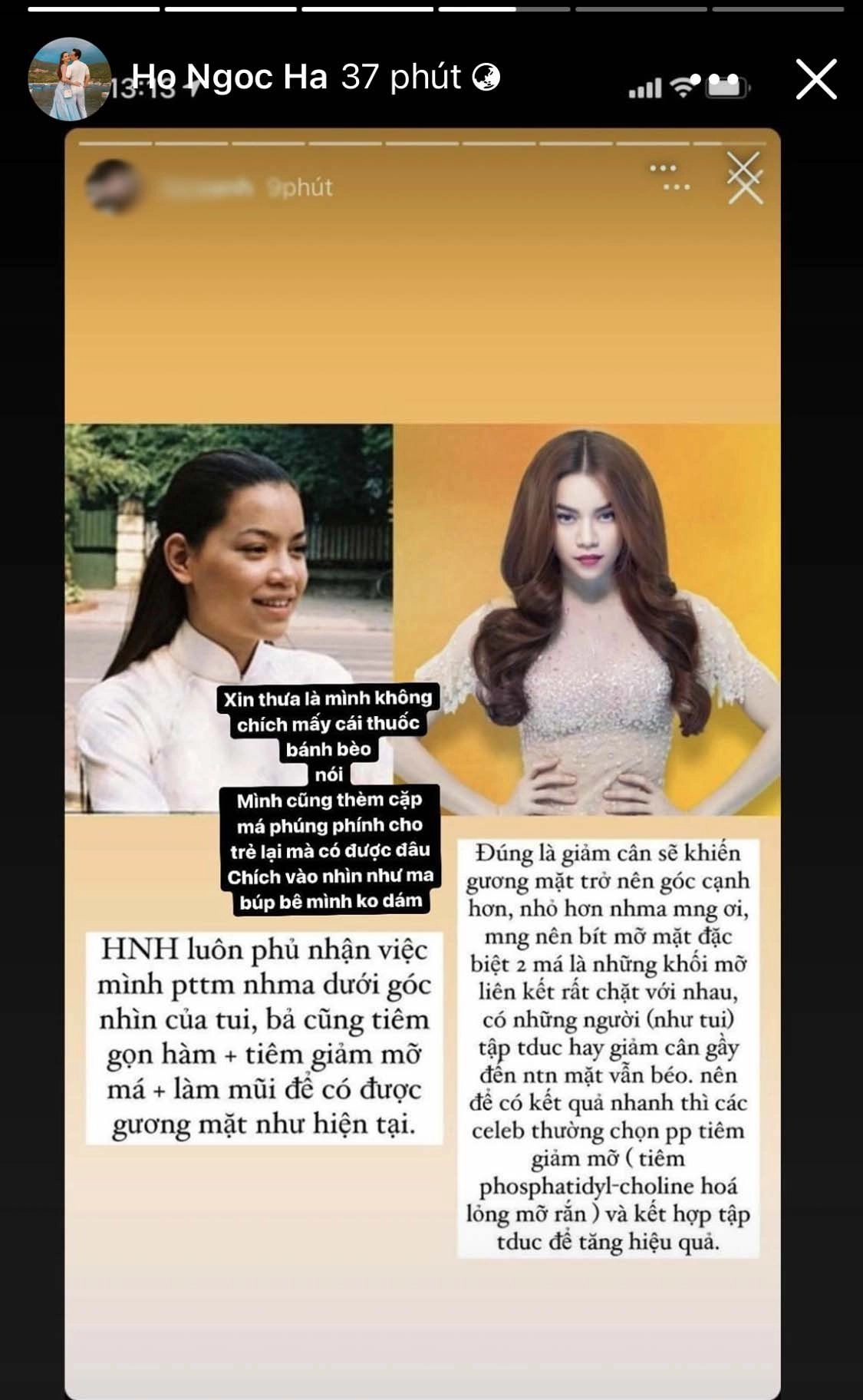 Bị nghitiêm chíchđủ thứ hà hồ thắng thắn thừa nhận thèm nhưng không dám sợ như ma búp bê - 1
