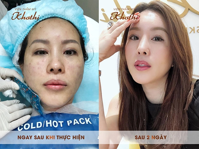 Bí quyết giữ mãi tuổi xuân của đôi bạn thân quyền lực- hh thu hoài và bà xã bình minh - 4