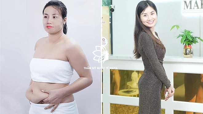 Bí quyết giúp mẹ 2 con giảm mỡ toàn thân sở hữu vóc dáng siêu gợi cảm - 1