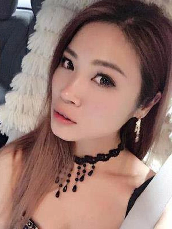 Biến chứng thẩm mỹ đến hoa hậu cũng không thoát khỏi - 8