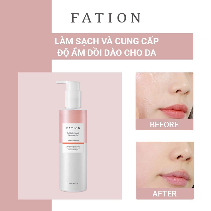 Bộ 4 sản phẩm hỗ trợ phục hồi da của thương hiệu fation - 1