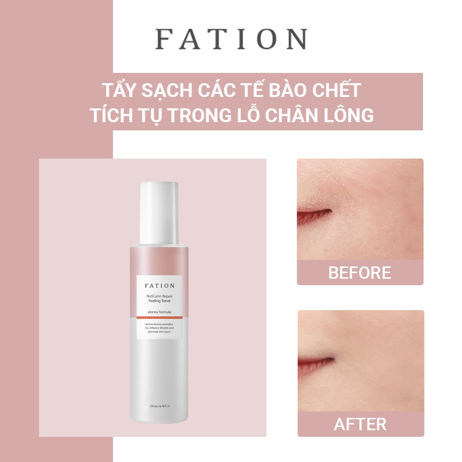 Bộ 4 sản phẩm hỗ trợ phục hồi da của thương hiệu fation - 3