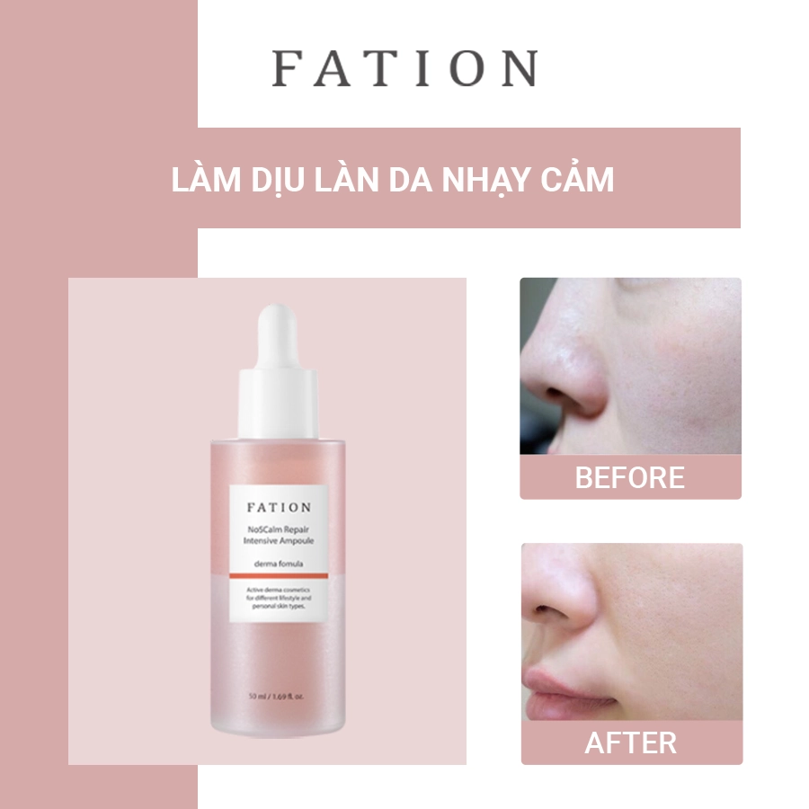 Bộ 4 sản phẩm hỗ trợ phục hồi da của thương hiệu fation - 5