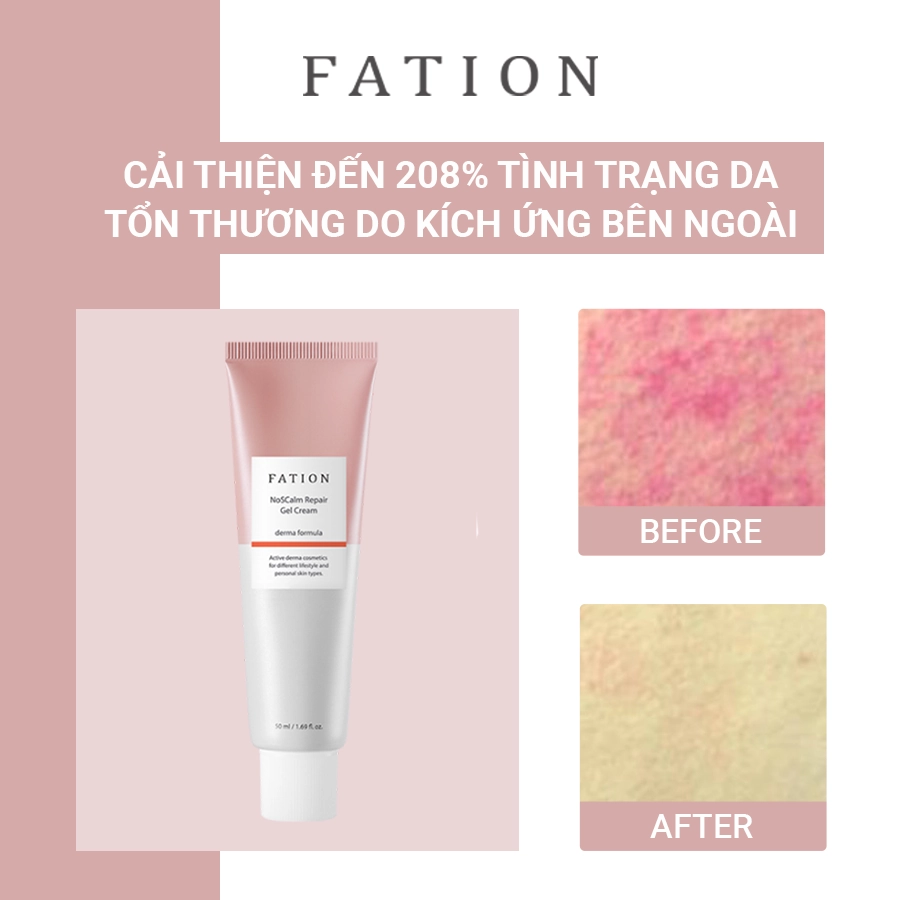 Bộ 4 sản phẩm hỗ trợ phục hồi da của thương hiệu fation - 7