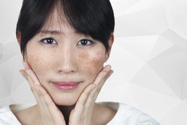 Bộ đôi sakuratine whitening và melasma cream giải pháp thổi bay sạm nám an toàn - 1