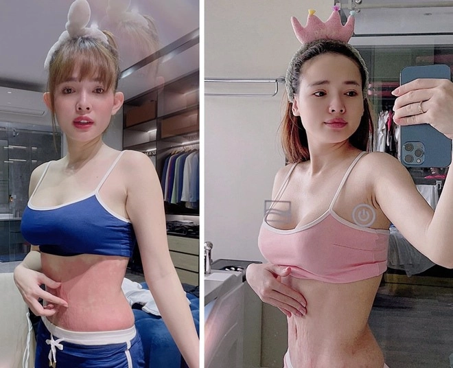 Bụng rạn nát bét vì 3 năm sinh 2 con hotgirl đà nẵng giờ siết eo suốt đêm đi ngủ - 7