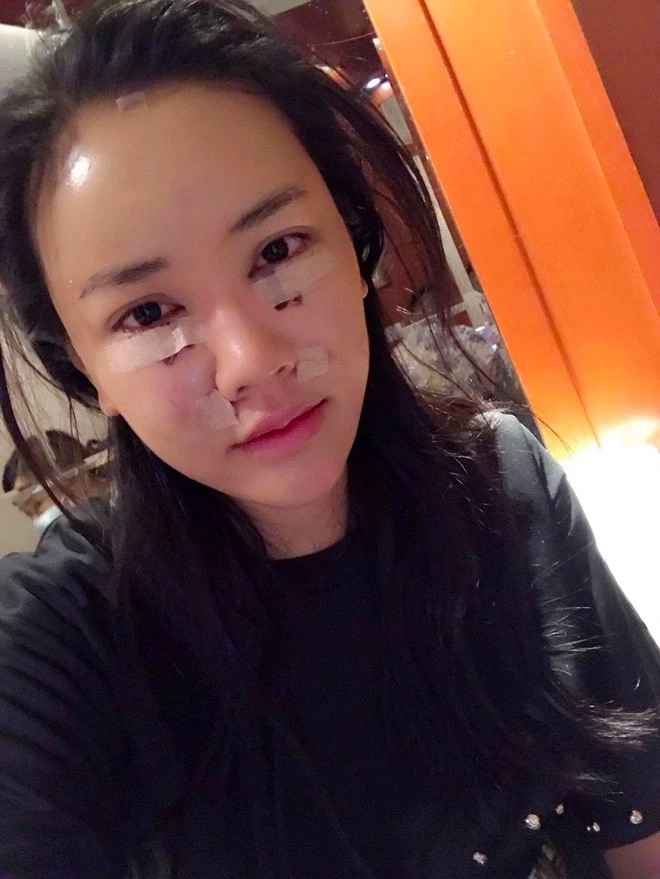 Ca sĩ từng được nhận định quyến rũ hơn hồ ngọc hà vẫn quyết dao kéo níu giữ thanh xuân - 13
