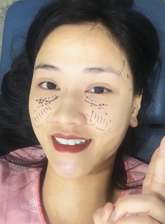 Ca sĩ từng được nhận định quyến rũ hơn hồ ngọc hà vẫn quyết dao kéo níu giữ thanh xuân - 20