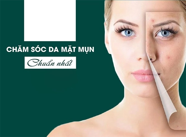 Cách chăm sóc da mụn đúng cách tại nhà với 7 bước đơn giản - 10