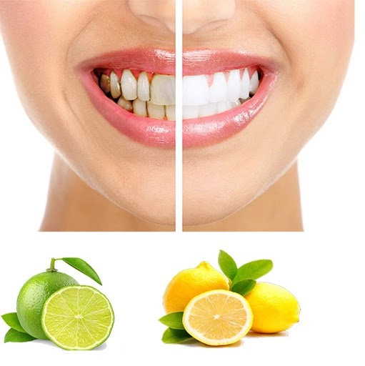 Cách làm trắng răng tại nhà đơn giản và hiệu quả nhất - 4