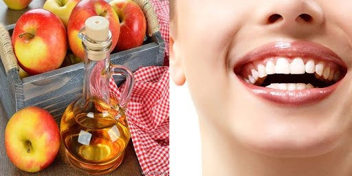 Cách làm trắng răng tại nhà đơn giản và hiệu quả nhất - 9