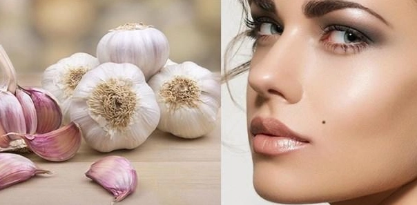 Cách tẩy nốt ruồi an toàn và hướng dẫn chăm sóc sau tẩy tại nhà - 2