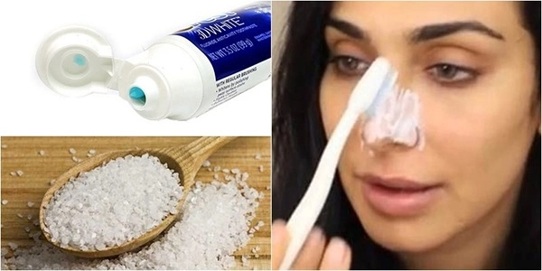 Cách trị mụn đầu đen tại nhà hiệu quả để có làn da trắng sáng mịn màng - 2