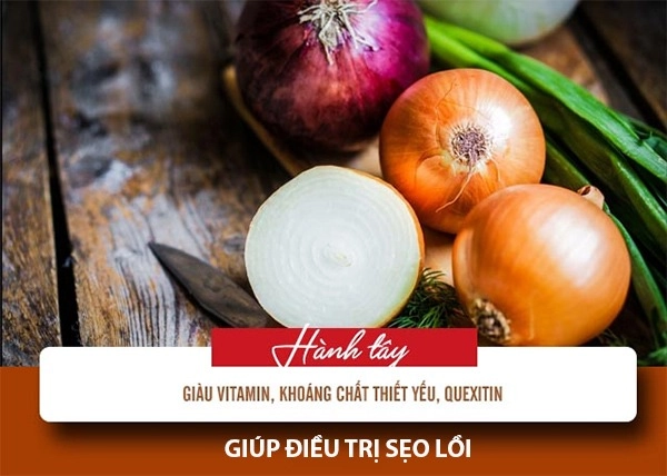 Cách trị sẹo lồi bằng các phương pháp tự nhiên an toàn hiệu quả nhanh nhất - 6
