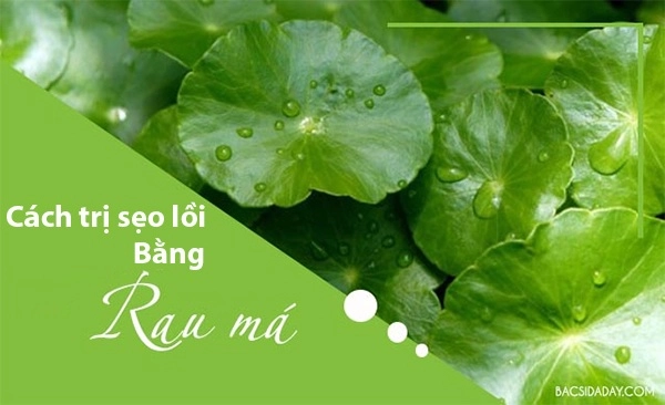 Cách trị sẹo lồi bằng các phương pháp tự nhiên an toàn hiệu quả nhanh nhất - 7