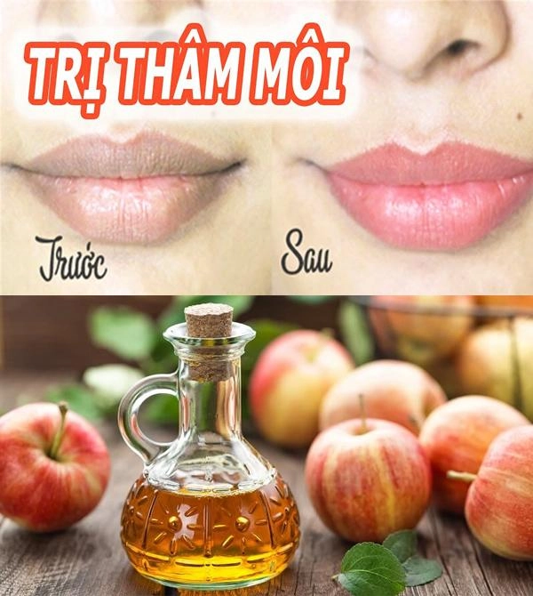 Cách trị thâm môi tại nhà nhanh nhất từ nguyên liệu thiên nhiên dễ kiếm - 13