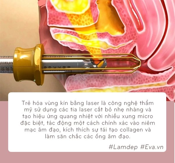 Can thiệp thẩm mỹ để lấy lại vẻ đẹp như thời con gái cho cô bé - nên hay không - 2