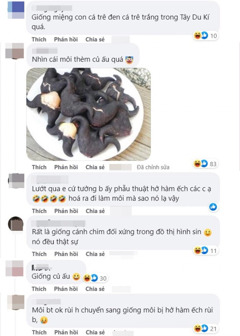 Cắt môi trái tim gái xinh nhận về đôi môi như củ ấu có ca còn như cửa không cánh - 3