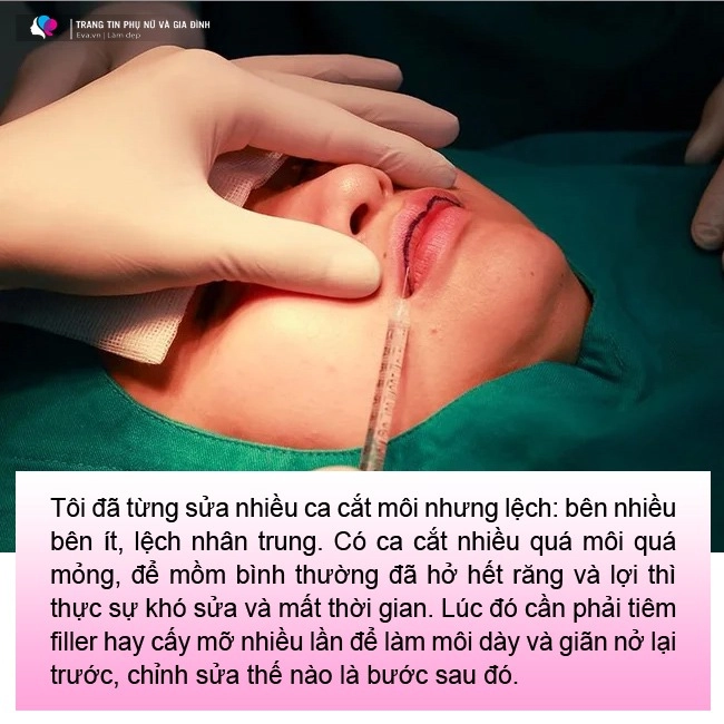 Cắt môi trái tim gái xinh nhận về đôi môi như củ ấu có ca còn như cửa không cánh - 7