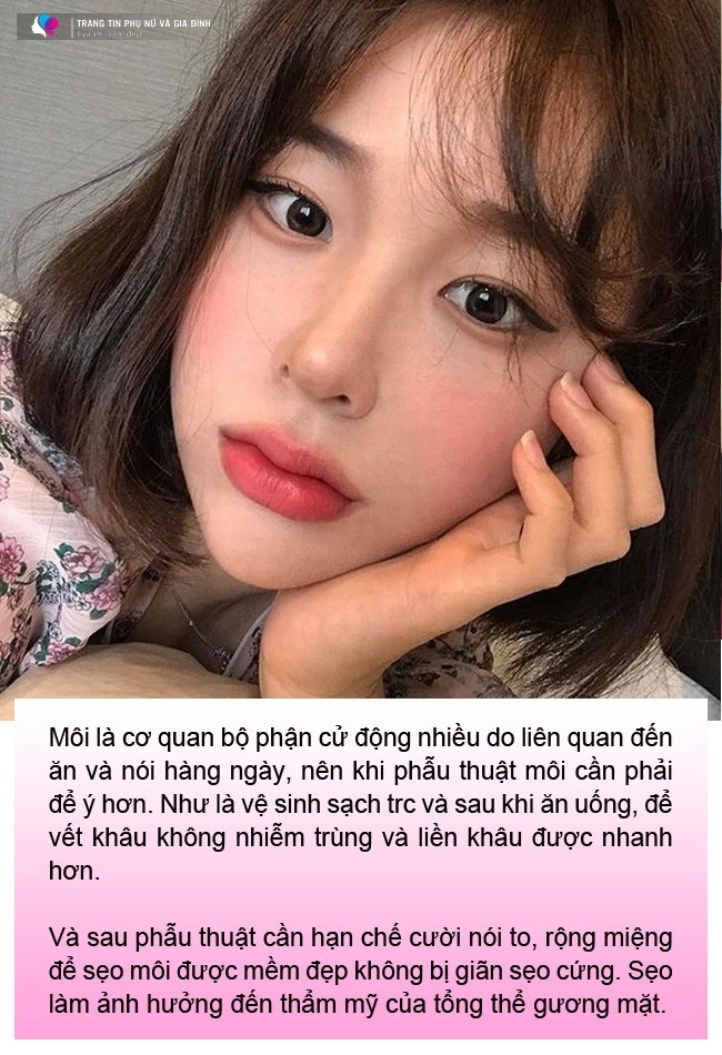 Cắt môi trái tim gái xinh nhận về đôi môi như củ ấu có ca còn như cửa không cánh - 8