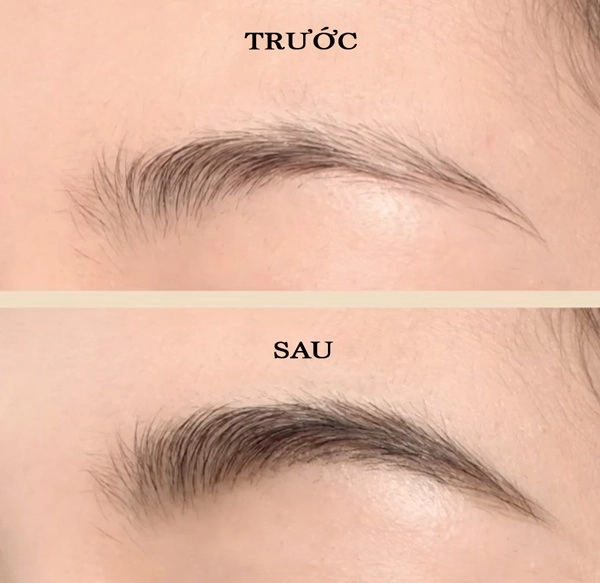 Cấy lông mày - phương pháp làm đẹp không đau phái đẹp yêu thích nhất - 8