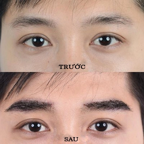 Cấy lông mày - phương pháp làm đẹp không đau phái đẹp yêu thích nhất - 9