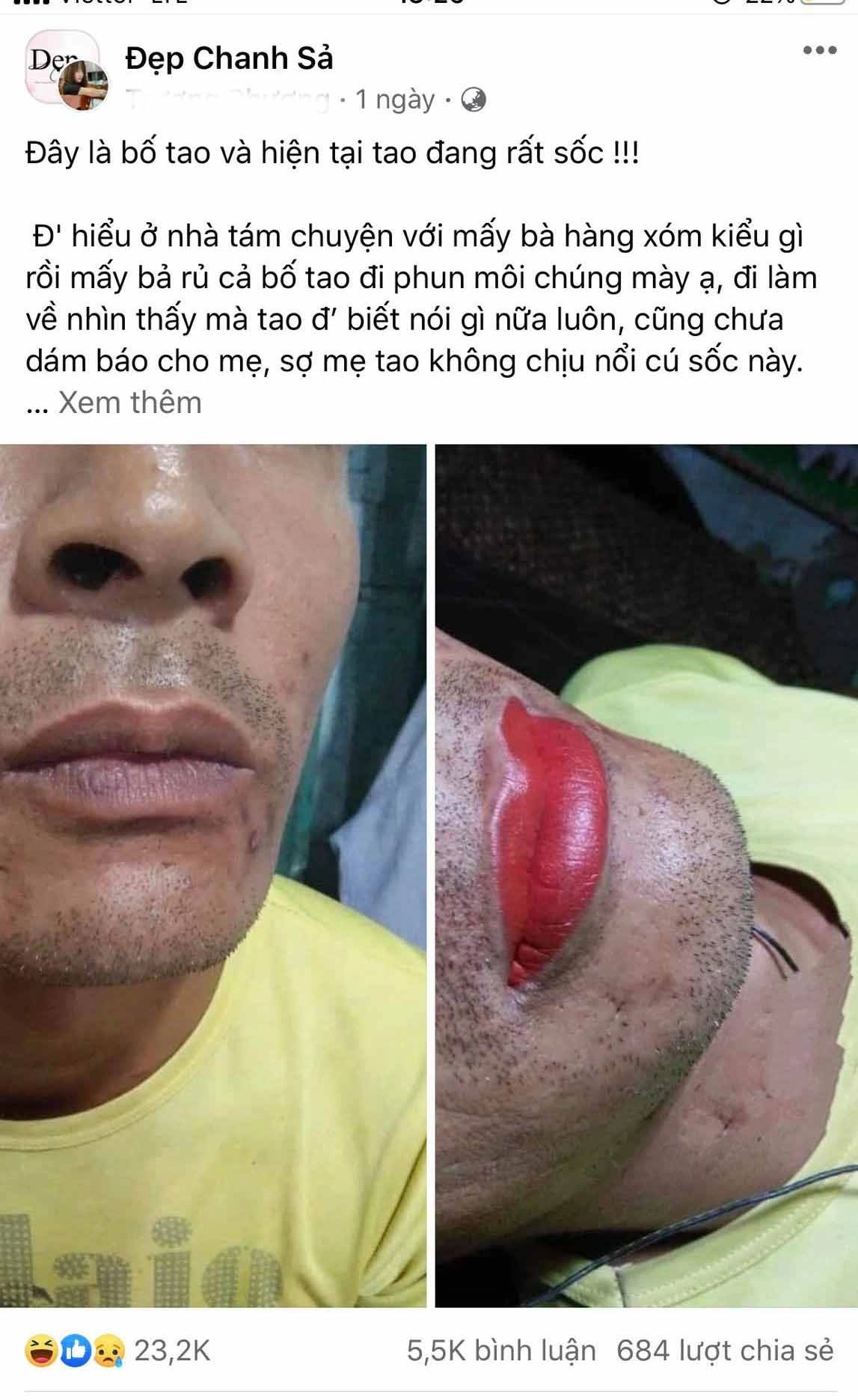 Cđm phát sốt với ông bố chất chơi trốn vợ con đi phun xăm môi và cái kết bất ngờ - 1