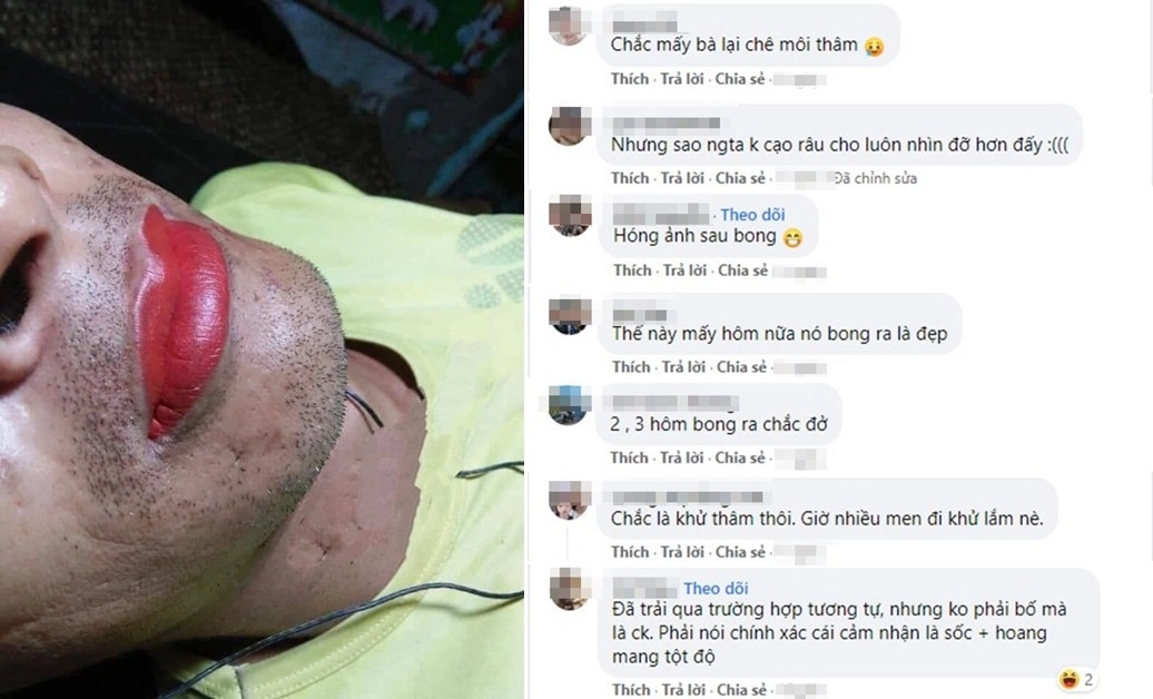 Cđm phát sốt với ông bố chất chơi trốn vợ con đi phun xăm môi và cái kết bất ngờ - 2