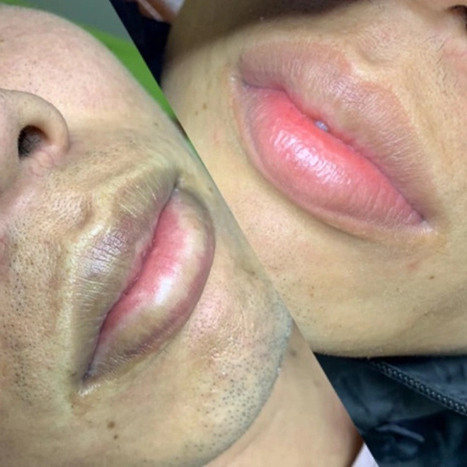 Cđm phát sốt với ông bố chất chơi trốn vợ con đi phun xăm môi và cái kết bất ngờ - 3