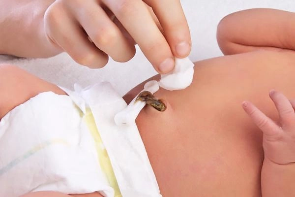 Chăm sóc trẻ sơ sinh rụng rốn nhưng chưa khô - 2
