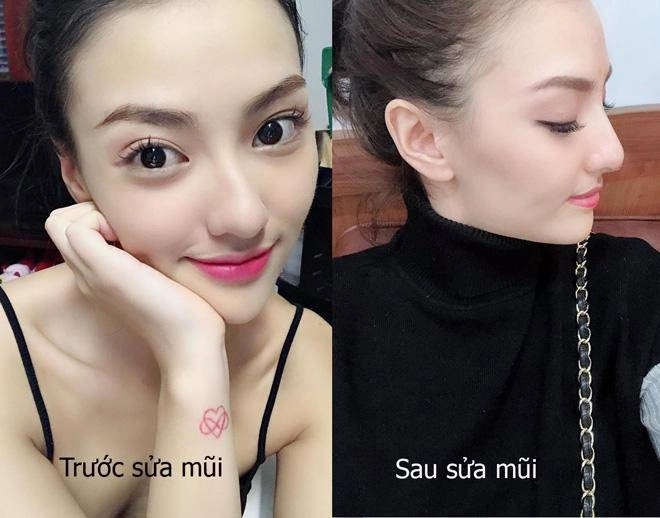 Chân dài xinh đẹp vẫn sợ lão hoá làm mũi collagen để luôn tươi trẻ - 5