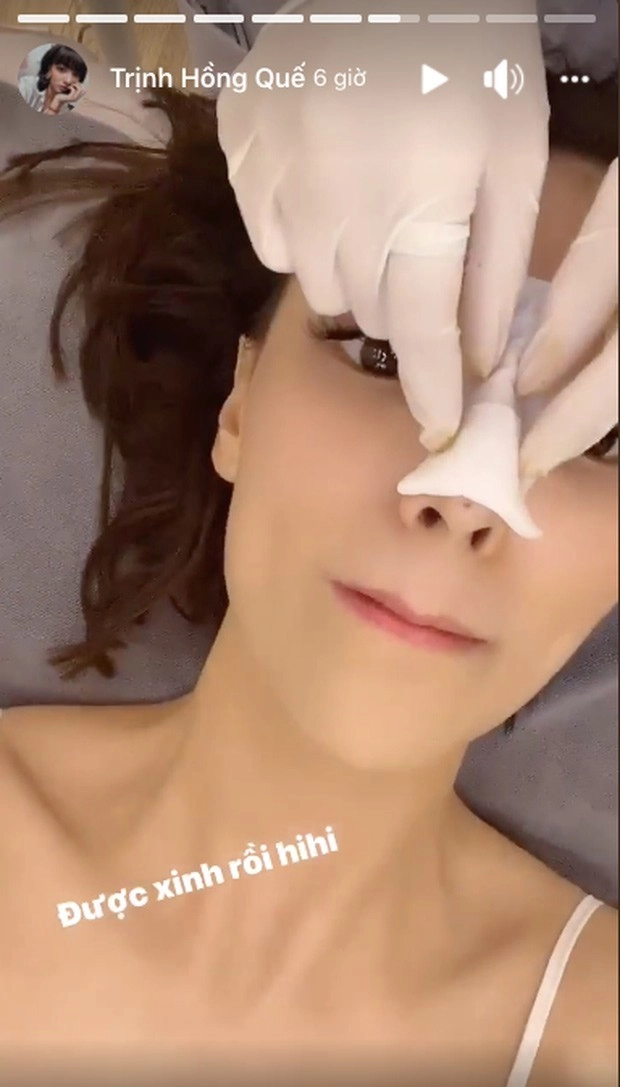 Chân dài xinh đẹp vẫn sợ lão hoá làm mũi collagen để luôn tươi trẻ - 7