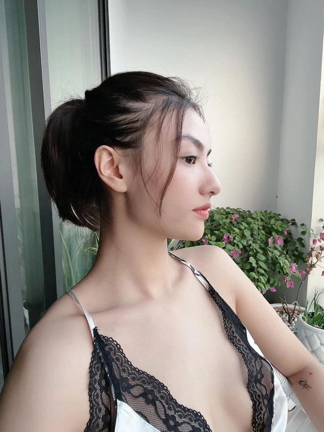 Chân dài xinh đẹp vẫn sợ lão hoá làm mũi collagen để luôn tươi trẻ - 14