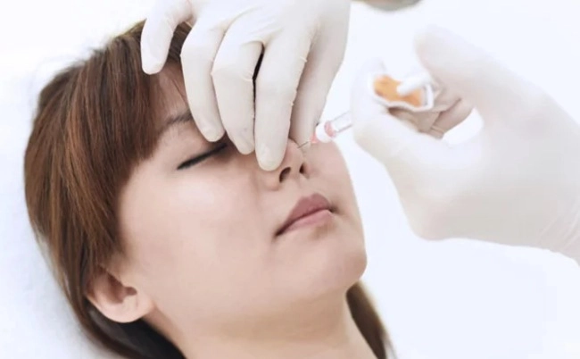 Cháu dâu tai tiếng của nữ hoàng anh lộ ảnh quá khứ liền dính nghi vấn trùng tu nhan sắc - 10