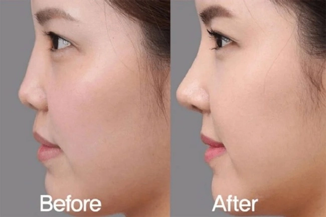 Cháu dâu tai tiếng của nữ hoàng anh lộ ảnh quá khứ liền dính nghi vấn trùng tu nhan sắc - 11