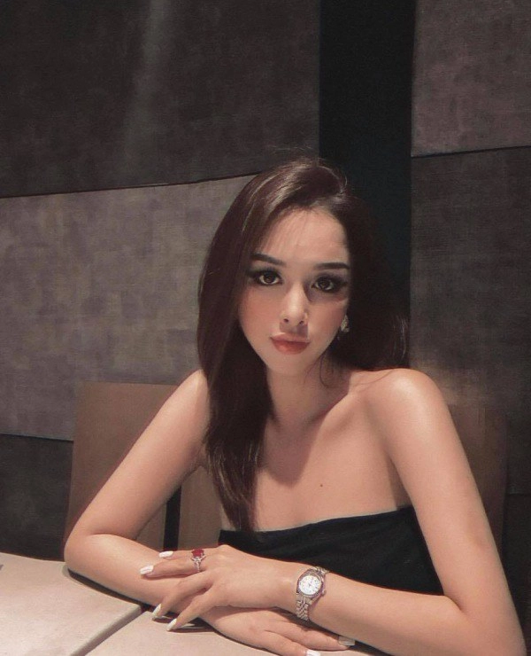Chi dau bao thy bi hoi hut mo canh tay tra loi kheo leo khang đinh đep tu nhien - 7