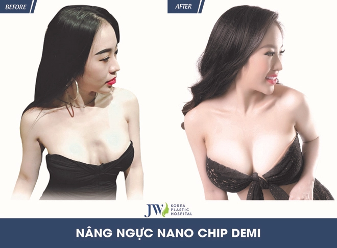 Chuyên gia cảnh báo đừng đặt cược tính mạng vì làm đẹp theo cách này - 3