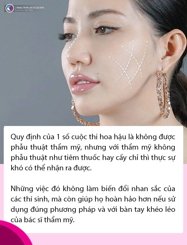 Chuyên gia hé lộ những biện pháp các thí sinh sắc đẹp thường thẩm mỹ để lách luật đi thi - 6