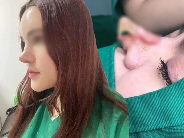 Chuyên gia hé lộ những biện pháp các thí sinh sắc đẹp thường thẩm mỹ để lách luật đi thi - 9