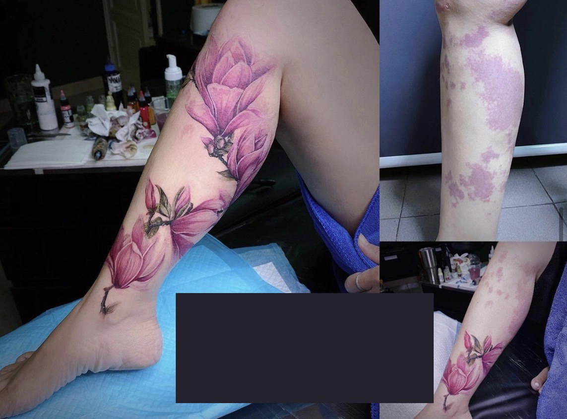 Chuyện về cô thợ xăm trồng hoa trên những vùng da sẹo xóa tự ti cho chị em sau sinh - 3