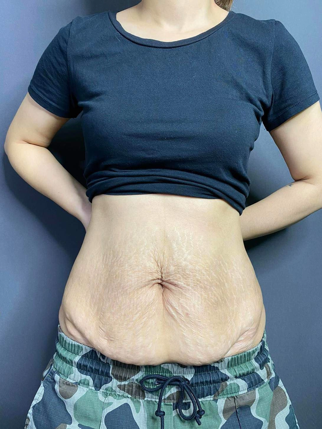 Chuyện về cô thợ xăm trồng hoa trên những vùng da sẹo xóa tự ti cho chị em sau sinh - 11