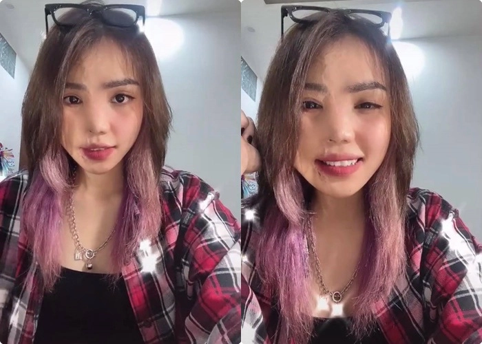 Cô gái bị chồng sắp cưới tạt axit nửa khuôn mặt giờ lột xác với diện mạo không nhận ra - 3