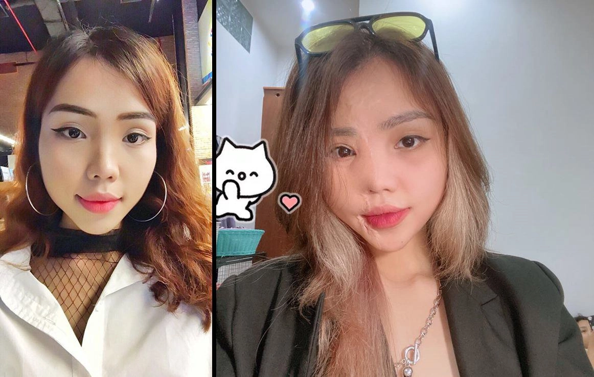Cô gái bị chồng sắp cưới tạt axit nửa khuôn mặt giờ lột xác với diện mạo không nhận ra - 13