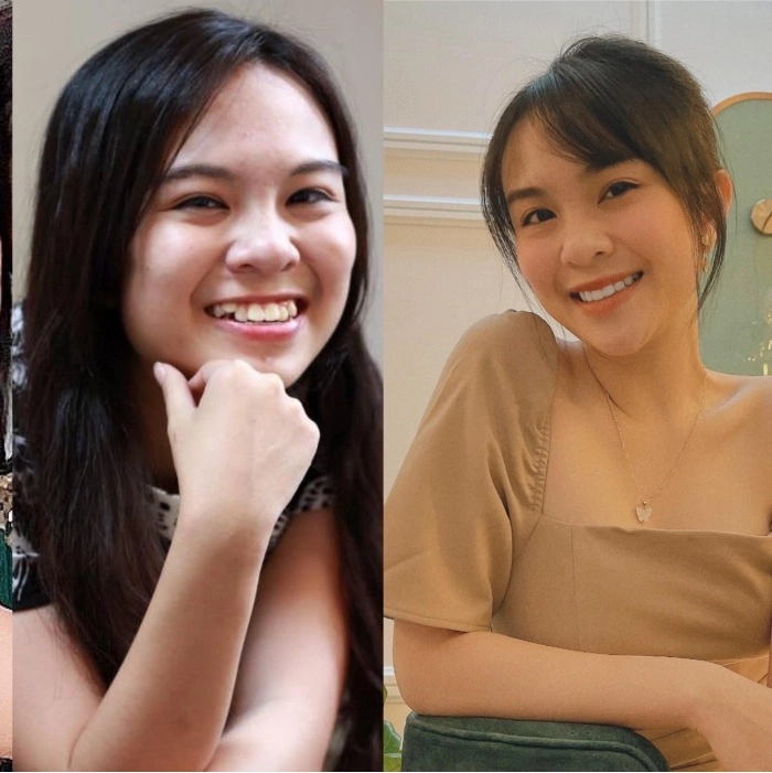 Cô gái dằn mặt người yêu cũ khi gỡ bỏ 8 chiếc răng từ vịt hoá thiên nga - 3