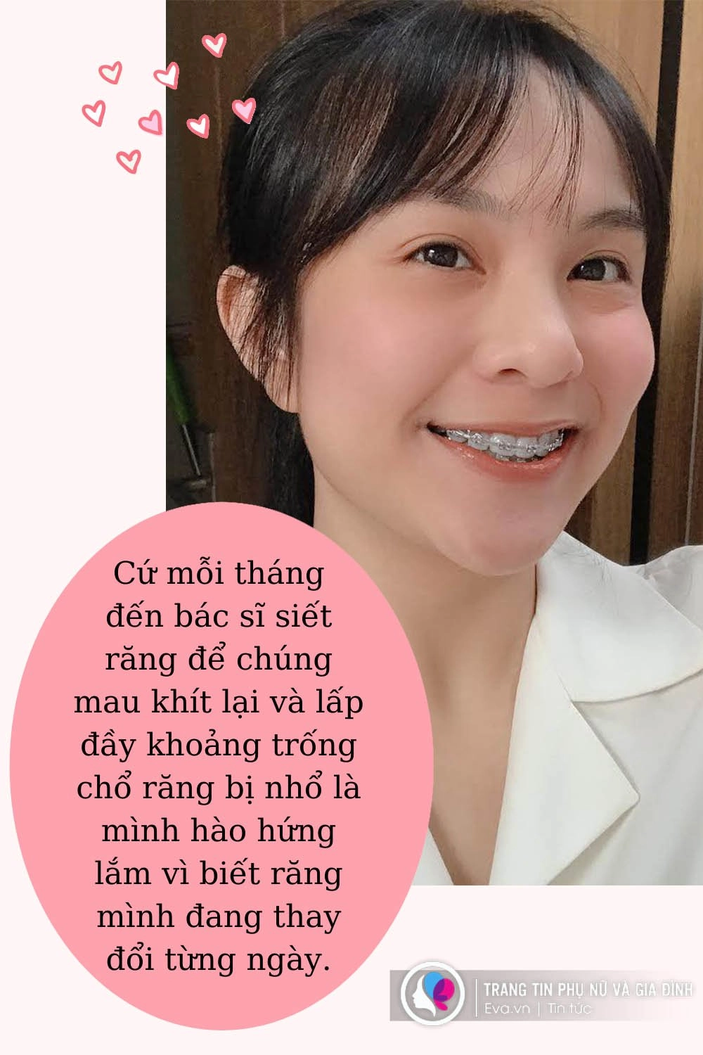 Cô gái dằn mặt người yêu cũ khi gỡ bỏ 8 chiếc răng từ vịt hoá thiên nga - 6